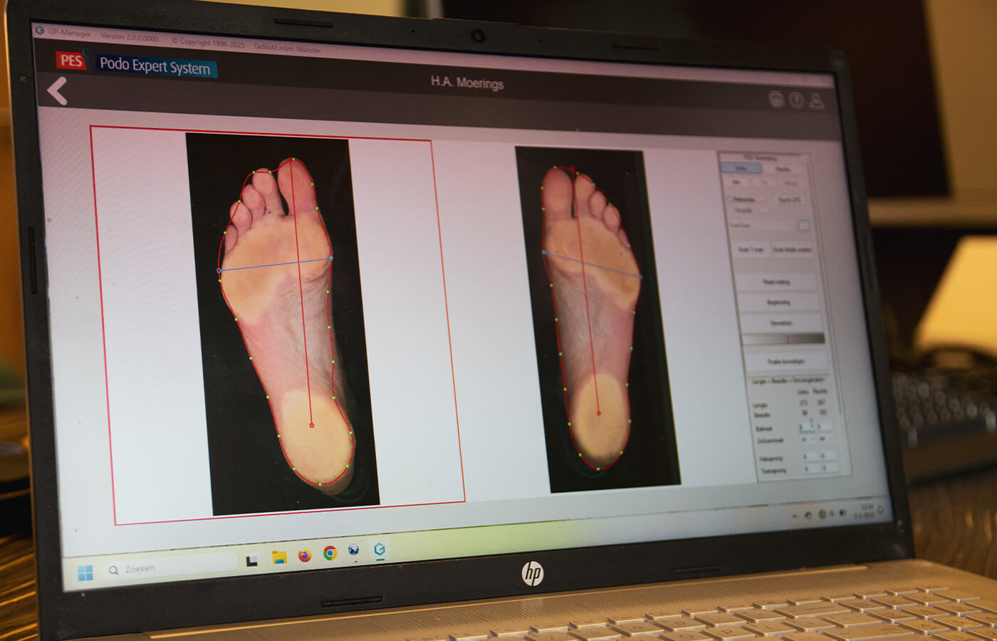 Kinderpodologie bij Podozorg Ameland Kinderpodologie bij Podozorg Ameland